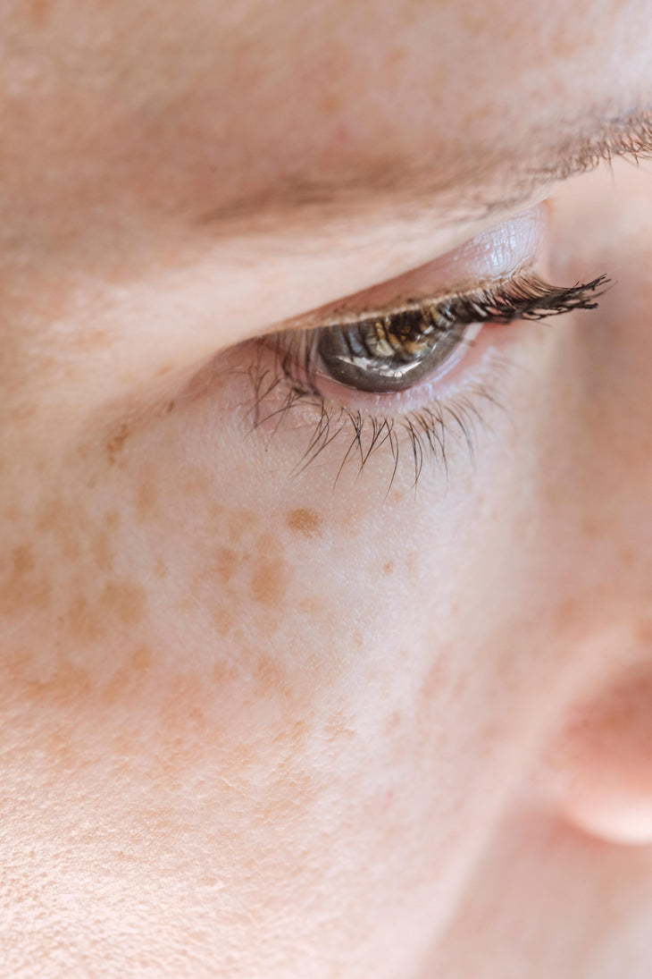Inflammaging: The Silent Driver of Premature Skin Aging